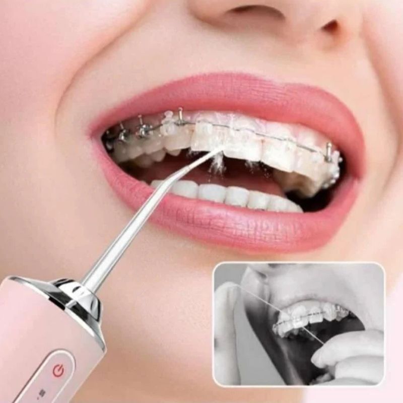 Oralni irigator, bezični prenosivi aparat za čišćenje desni i zuba i ispiranje usta